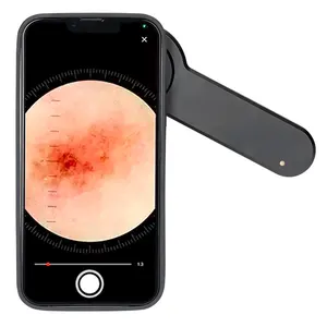IBOOLO डे-3100 जांच moles dermoscopic लेंस के साथ डबल प्रकाश dermoscope, दुनिया में सबसे अच्छा iphone के लिए dermatoscope