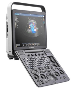 Mejor Precio del Ecógrafo Doppler Color Portátil Sonoscape S8EXPV con Monitor LED a Color de Alta Resolución de 15 Pulgadas para Hospital - Product Image 1