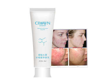 Loción Herbal para la Piel con Ácido Salicílico y Aceite de Árbol de Té, Crema Anti-Acné para Cicatrices de Acné, Pápulas y Manchas Negras en el Rostro - Product Image 1