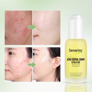 Custom Your logo Glycolic Acid Acne Serum Private Label Organic Gently Repair <strong>Pimples</strong> Anti Acne Shrinkage Hydration <strong>Face</strong> Serum - Product Image 2
