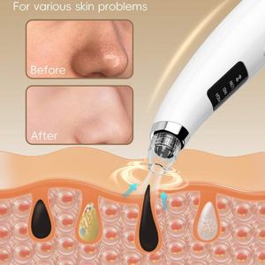 Extracteur de points noirs électrique à 5 têtes, aspirateur de pores, aspiration 53-63 KPA, batterie 400 mAh, garantie 12 mois, extracteur d'acné portable - Product Image 4