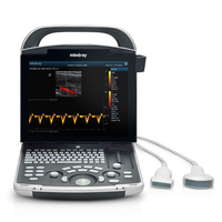 Ecógrafo Veterinario Mindray DP-30, Instrumento de Ultrasonido Veterinario Digital Portátil en Blanco y Negro para Uso General Básico con Sonda Convexa
