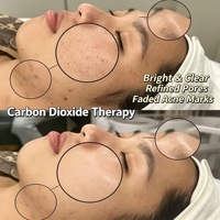 Mascarilla Facial de Oxígeno con Efecto Bohr y Gel de CO2 para Carboxiterapia al por Mayor, Kit de Carboxiterapia CO2 para Piel de Cristal Coreana