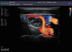 SONOSCAPE P25 Elite Appareil d'échographie 4D Scanner d'échographie médicale pour l'obstétrique, la gynécologie, la pédiatrie, l'urologie - Product Image 6