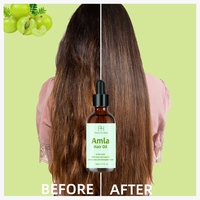 OEM ODM Huile d'Amla 100% Naturelle 50ml, Traitement Anti-Chute pour le Cuir Chevelu, Huile d'Amla Originale pour la Croissance des Cheveux