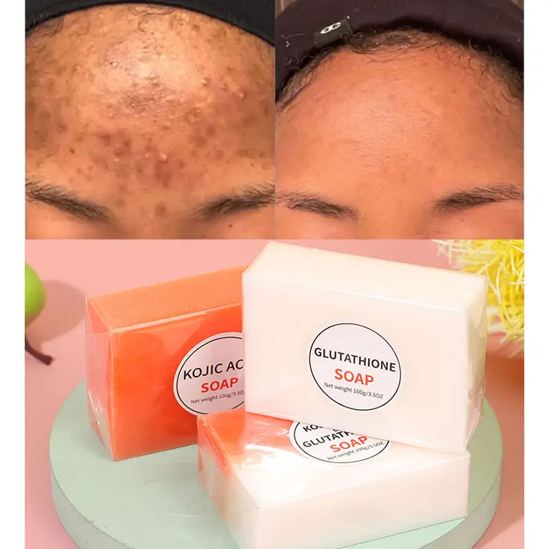 Sabonete kojic gluthione branqueador, sabonete kojic para clareamento da pele, limpeza profunda, antiacne, feito à mão