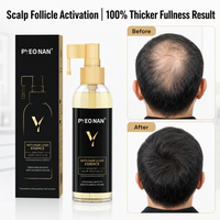 Sérum de traitement pour la croissance rapide des cheveux pour femmes et hommes, huile anti-chute de cheveux, sérum de repousse à base de plantes, marque privée, huile de biotine