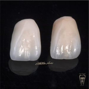 Kit de base en céramique de zircone BAOT PFZ, matériel de laboratoire <span class=keywords><strong>dentaire</strong></span> esthétique, zircone <span class=keywords><strong>dentaire</strong></span>, poudre de porcelaine <span class=keywords><strong>dentaire</strong></span> - Product Image 4