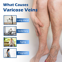 Crème de traitement des varices OEM, efficace pour soulager les jambes, formule de pommade pour les varices, dilatation vasculaire, phlébite