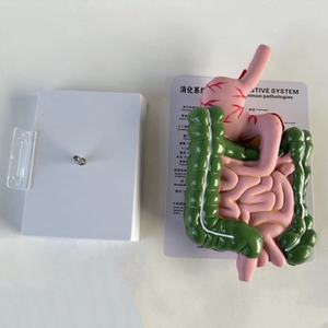 แบบจำลองทางกายวิภาคของระบบย่อยอาหารมนุษย์ที่ทำจากพีวีซี แสดงโรคทางพยาธิวิทยาในลำไส้ใหญ่ - Product Image 6