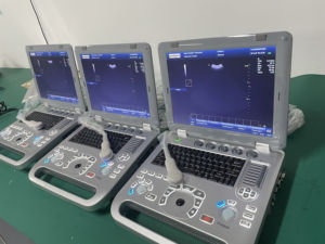 SUN-800F Klinikgeräte Präzisionsdiagnose Hunde- und Katzen-Tierarzt-<span class=keywords><strong>Doppler</strong></span>-Ultraschallgerät - Product Image 3