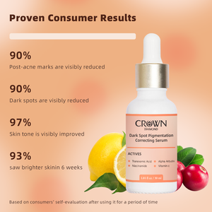 Sérum Visage <span class=keywords><strong>Anti</strong></span>-Imperfections Hydratant Éclaircissant à la Niacinamide, Alpha Arbutine et Vitamine C, Correcteur de Pigmentation et <span class=keywords><strong>Anti</strong></span>-Acné, Marque Blanche - Product Image 4