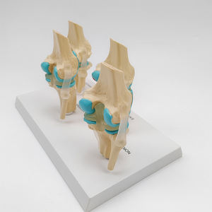 Modelo Anatómico de <span class=keywords><strong>Esqueleto</strong></span> <span class=keywords><strong>Humano</strong></span> de Tamaño Real, Modelo de Articulación de <span class=keywords><strong>Rodilla</strong></span> Enferma en 4 Etapas para Enseñanza - Product Image 2
