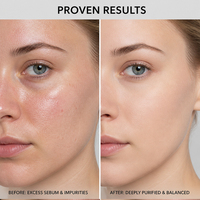 Nettoyant Visage Liquide Hydratant Purifiant Peau Légèrement Acidulée Doux Démaquillant Crème Lait Nettoyant Huileux Marque Privée