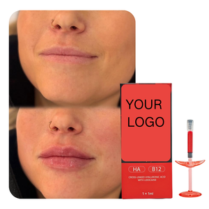 Filler Labbra Rosso da 1ml con Vitamina B12 e <span class=keywords><strong>Acido</strong></span> <span class=keywords><strong>Ialuronico</strong></span> per Labbra Naturalmente Morbide, Voluminose e Luminose - Product Image 4