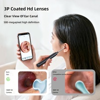 Endoscope Visuel Numérique HD avec Caméra Auriculaire, Éclairage LED, en ABS et Acier Inoxydable, pour l'Inspection et le Nettoyage Magique des Oreilles, avec Bâtonnet de Nettoyage Auriculaire