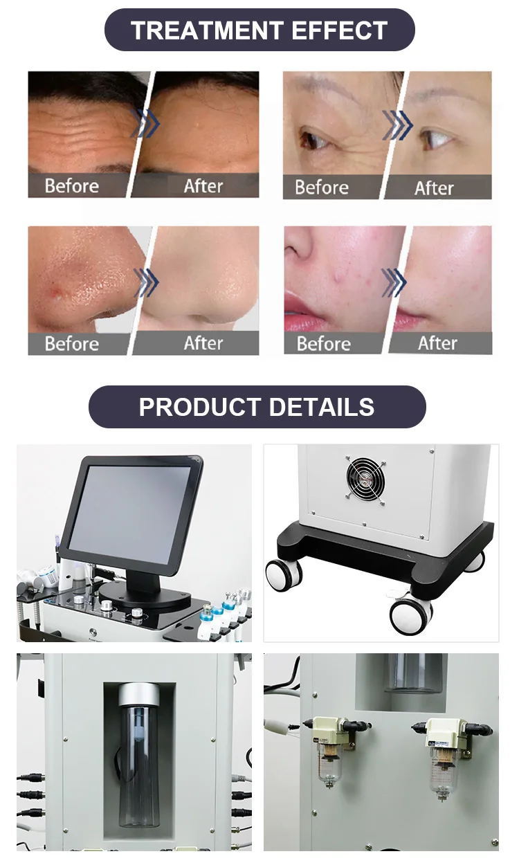14 az 1-ben Hydrofacial Machine – Oxigén-víz dermabrázió, Hidratáló bőrtisztítás, Arcfiatalító Szépségfelszerelés