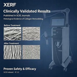 เครื่องกระชับสัดส่วน Xerf รุ่นใหม่ล่าสุด ปี 2026 แบบสองความถี่ ไม่ต้องผ่าตัด  ชนิดยืน  ความถี่คู่ 6.78mhz 2mhz - Product Image 3
