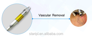 Eliminación de manchas <span class=keywords><strong>vasculares</strong></span> con láser Vena varicosa Araña Endoláser Liposucción Lipólisis Estiramiento facial 980 1470nm Dispositivo cosmético para el cuidado de la piel - Product Image 4