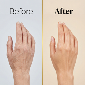 Cápsulas <span class=keywords><strong>de</strong></span> Ácido Hialurónico OEM a Mejor <span class=keywords><strong>Precio</strong></span>, Biotina, Colágeno, Vitamina C, Suplementos Naturales para la Hidratación <span class=keywords><strong>de</strong></span> la Piel - Product Image 6