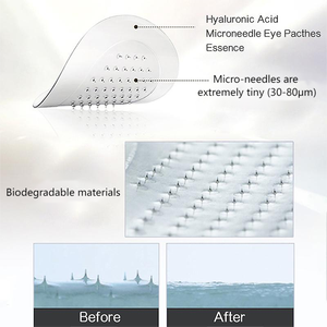 Microneedling Anti-Rides Rétinol Personnalisé <span class=keywords><strong>Sous</strong></span> Patchs Pour <span class=keywords><strong>Les</strong></span> Cernes Poches - Product Image 6