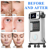 Appareil multifonctionnel 8 en 1 à jet d'eau et d'oxygène vertical, hydrodermabrasion, nettoyage en profondeur du visage, équipement de rajeunissement de la peau