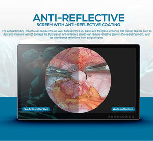 एंटी बैक्टीरियल 4K अल्ट्रा एचडी सर्जिकल मॉनिटर, ऑपरेटिंग रूम के साथ एंटीबैक्टीरियल 4K अल्ट्रा एचडी सर्जिकल मॉनिटर 3840 लिए 2160 - Product Image 2