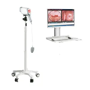 婦人科用医療用デジタルビデオコルポスコープ膣コルポスコープColposcopio HD CCD、トロリースタンド価格