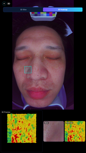 เครื่องวิเคราะห์ผิว AI แบบหลายสเปกตรัม อุปกรณ์วิเคราะห์ใบหน้าผ่าน WiFi มาตรฐาน EU <span class=keywords><strong>ส</strong></span>ำหรับร้านเ<span class=keywords><strong>ส</strong></span>ริมสวย ตรวจจับสิว ฝ้า กระ ริ้วรอย และความชุ่มชื้น - Product Image 6
