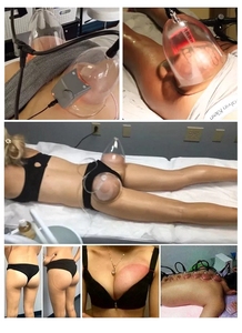 Grande Coupe Agrandissement Du Sein Aspiration Thérapie Sous Vide Lifting Des Fesses Ventouses Massage <span class=keywords><strong>Machine</strong></span> De Réduction De La <span class=keywords><strong>Cellulite</strong></span> - Product Image 4