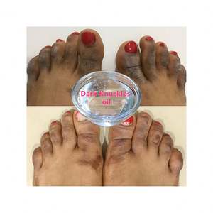 Sérum visage anti-âge Acide hyaluronique Vitamine C Squalane Huile d'émeu Hydratant Réparateur Blanchissant Hamamélis Thé vert Cosmétiques - Product Image 1