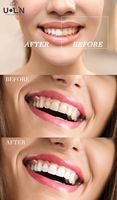 Lot de 10 gels blanchissants pour les dents au peroxyde de carbamide, gel blanchissant dentaire, seringue dentaire de 3 ml, vente en gros