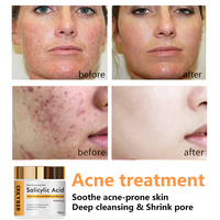 Patch d'essence d'acide salicylique organique Feuille de visage exfoliante de voyage pour le nez Traitement anti-acné éclaircissant pour toutes les peaux