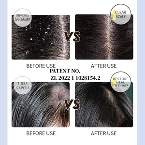 Champú en Crema de Alta Calidad Anticaída, Hidratante y Nutritivo, Unisex, Anticaspa, Tratamiento Anticaída para Cabello Seco y Encrespado - Product Image 5
