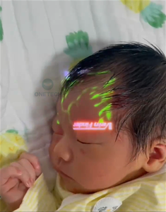 Yüz ameliyatı için VF12 pediatrik kan damarı bulucu/ven dedektörü/taşınabilir damar bulucu - Product Image 5