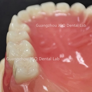 Las dentaduras postizas de boca completa personalizadas, los dientes acrílicos ofrecen una estabilidad mejorada para masticar, comer y hablar con un precio asequible - Product Image 2