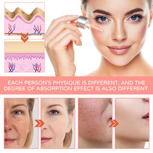 Label privé meilleur vendeur 5 en 1 naturel organique végétalien éclaircissant blanchissant acide hyaluronique visage vitamine c sérum de soin de la peau <span class=keywords><strong>d</strong></span> - Product Image 5