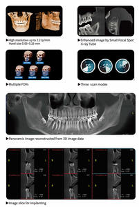 <span class=keywords><strong>Machine</strong></span> à rayons X <span class=keywords><strong>dentaire</strong></span> <span class=keywords><strong>panoramique</strong></span> numérique <span class=keywords><strong>Prix</strong></span> oral Scanner CBCT 3D - Product Image 5
