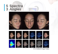 Escáner facial completo MC10, equipo analizador de piel, tecnología AI para análisis de problemas faciales, características hidratantes, EU IT JP US ZA