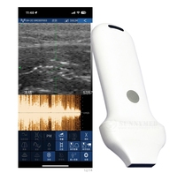 Sonde d'échographie portable sans fil 20 Hz à 192 éléments pour soins esthétiques de la peau