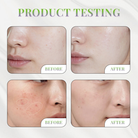 Sérum Lyophilisé Complexe de Collagène Recombinant et Hyaluronate de Sodium – Formule Lyophilisée pour Soin Réparateur Post-Procédure Cutanée