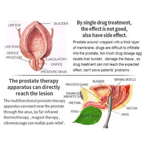 Mesin terapi prostat elektromagnetik aman dan efektif untuk perawatan urologi - Product Image 6