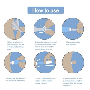 Thẻ Da Giết Nốt Ruồi Mụn Cơm Remover Micro Skin Auto Tag Removal Kit Với Làm Sạch Gạc Người Lớn Mole Mụn Cơm Chăm Sóc Mặt - Product Image 5