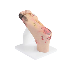 Modello didattico del piede diabetico, Modello del piede per infermieristica, Modello patologico - Product Image 3