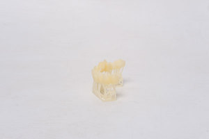 Résine dentaire ESUN TC100 pour imprimante 3D, 405 nm, 1 kg, pour couronnes et bridges temporaires, couleur naturelle des dents, matières premières plastiques, haute résistance à l'usure - Product Image 3