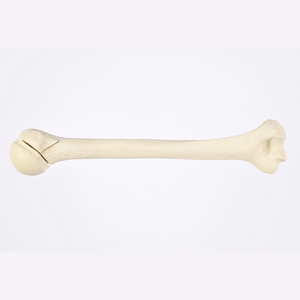 Kyrenmed cortical humerus ขวา fractureed กับ proximal humerus fracture สำหรับการประชุมเชิงปฏิบัติการการตัดเจาะ - Product Image 1