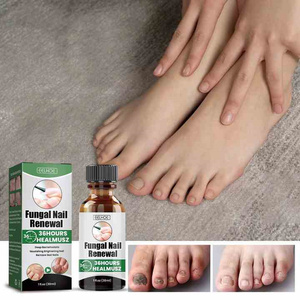 Suministro de Alta Calidad para el Cuidado de la Salud, Potente Antifúngico para la Regeneración de Uñas, Esencia Calmante y Reparadora en Formato Líquido - Product Image 3