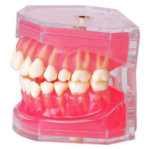Modèle dentaire HDF M7008 avec gencives souples et dents extractibles, pour démonstration pédagogique, équipement d'enseignement médical et de thérapie orale - Product Image 3