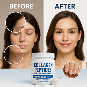 Poudre <span class=keywords><strong>de</strong></span> <span class=keywords><strong>Collagène</strong></span> <span class=keywords><strong>Marin</strong></span> <span class=keywords><strong>Hydrolysé</strong></span> Complexe <span class=keywords><strong>de</strong></span> Peptides <span class=keywords><strong>de</strong></span> <span class=keywords><strong>Collagène</strong></span> avec Biotine pour la Beauté - 300g Poudre Minceur pour Femmes Certifiée par un tiers - Product Image 1