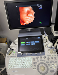 Fourniture et réparation d'écran tactile/écran LCD/moniteur pour machine à ultrasons Voluson E8/E10/E6 - Product Image 6